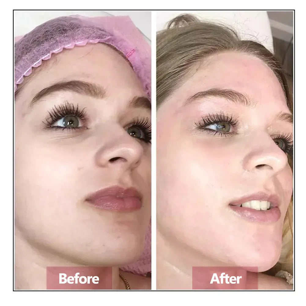 Hyaluronic Acid Face Serum Essence Skin Repair